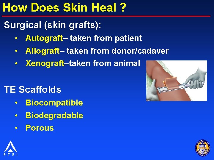 How Does Skin Heal ? Surgical (skin grafts): • Autograft– taken from patient •