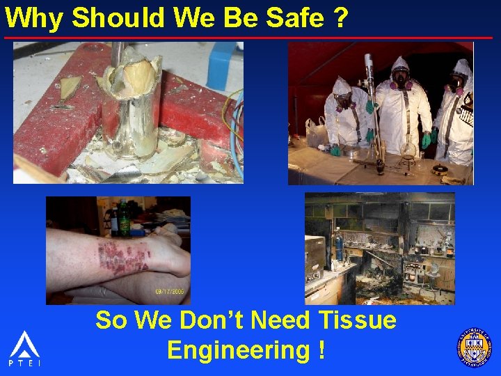 Why Should We Be Safe ? So We Don’t Need Tissue Engineering ! 