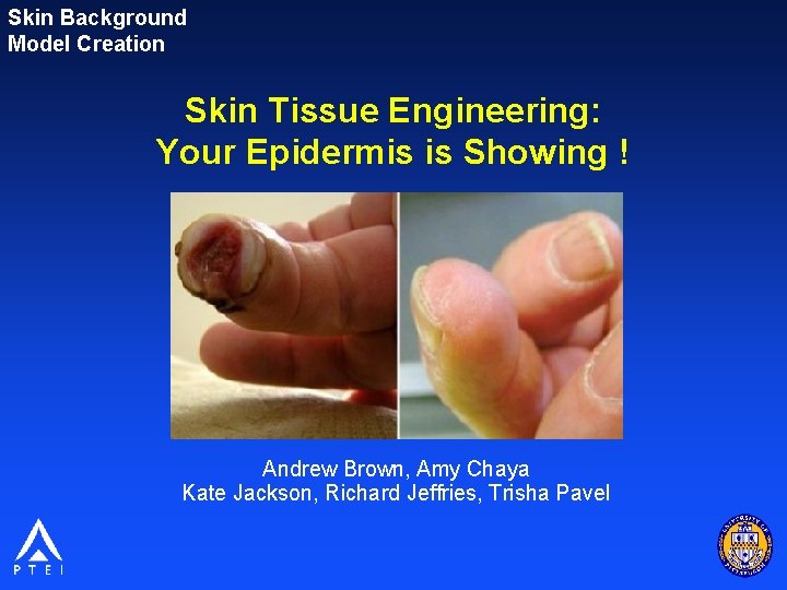 Skin Background Model Creation Skin Tissue Engineering: Your Epidermis is Showing ! Andrew Brown,