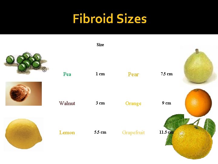 Fibroid Sizes Size Pea 1 cm Pear 7. 5 cm Walnut 3 cm Orange