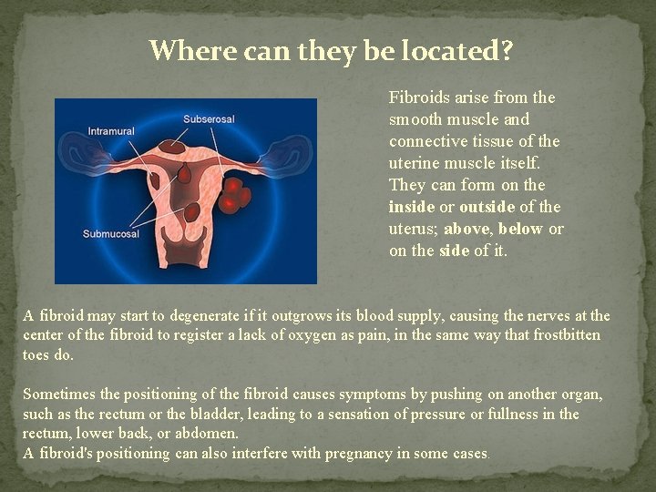 Where can they be located? Fibroids arise from the smooth muscle and connective tissue