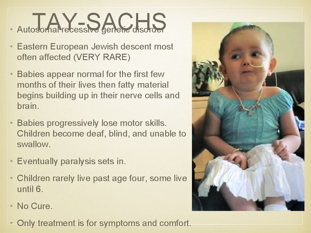 TAY-SACHS • Autosomal recessive genetic disorder • Eastern European Jewish descent most often affected