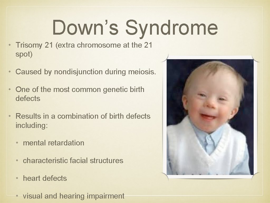 Down’s Syndrome • Trisomy 21 (extra chromosome at the 21 spot) • Caused by