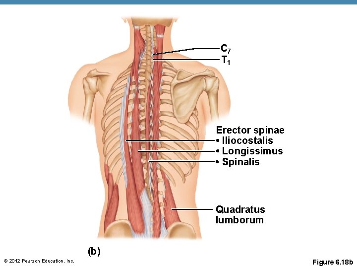 C 7 T 1 Erector spinae • Iliocostalis • Longissimus • Spinalis Quadratus Iumborum