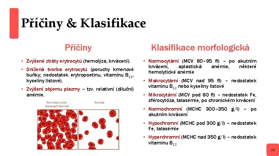 Příčiny & Klasifikace Příčiny • Zvýšené ztráty erytrocytů (hemolýza, krvácení). • Snížená tvorba erytrocytů