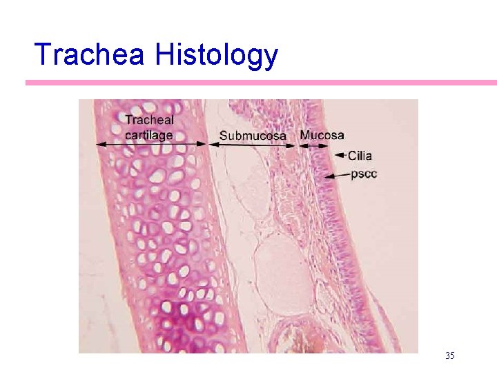 Trachea Histology 35 