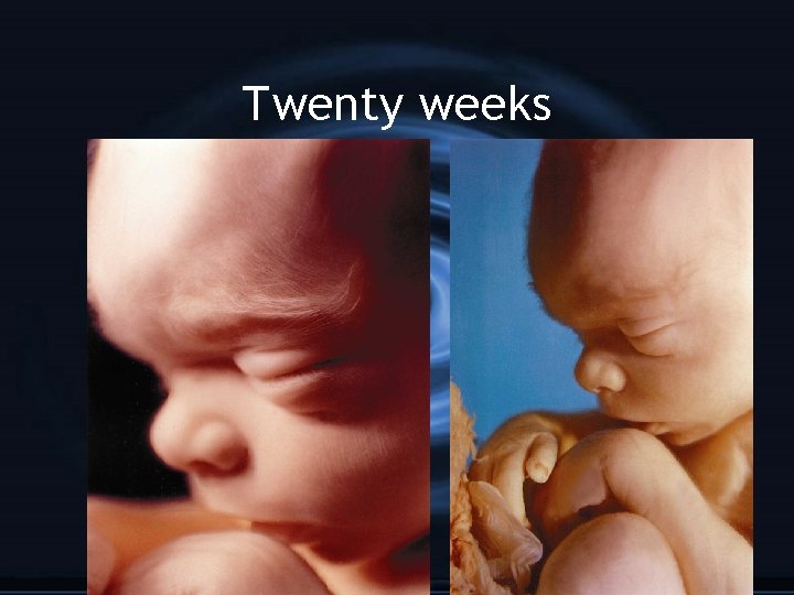 Twenty weeks 