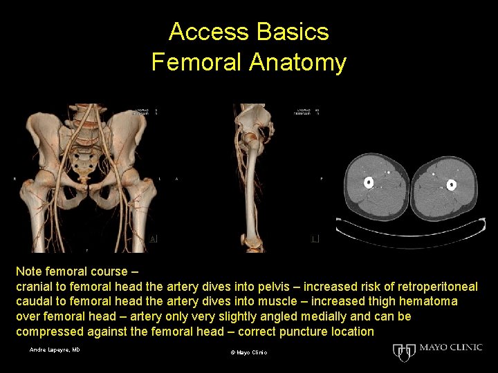 Access Basics Femoral Anatomy Note femoral course – cranial to femoral head the artery