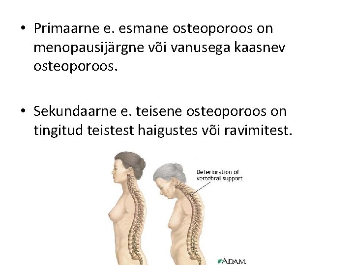  • Primaarne e. esmane osteoporoos on menopausijärgne või vanusega kaasnev osteoporoos. • Sekundaarne