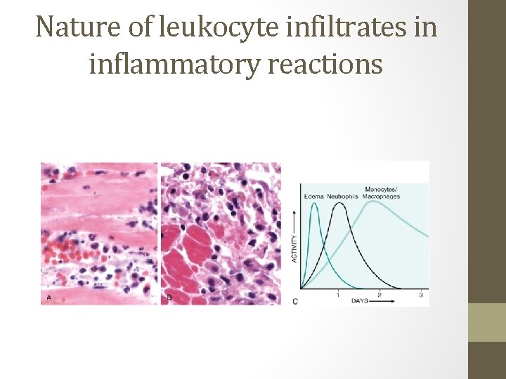 Nature of leukocyte infiltrates in inflammatory reactions 