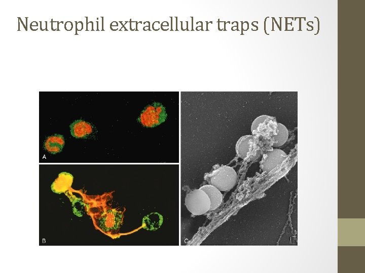 Neutrophil extracellular traps (NETs) 