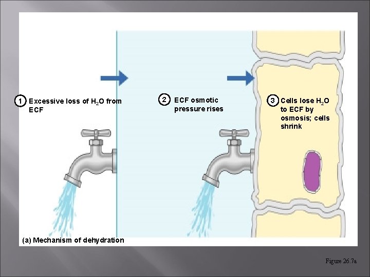 1 Excessive loss of H 2 O from ECF 2 ECF osmotic pressure rises 1 Excessive loss of H 2 O from ECF 2 ECF osmotic pressure rises
