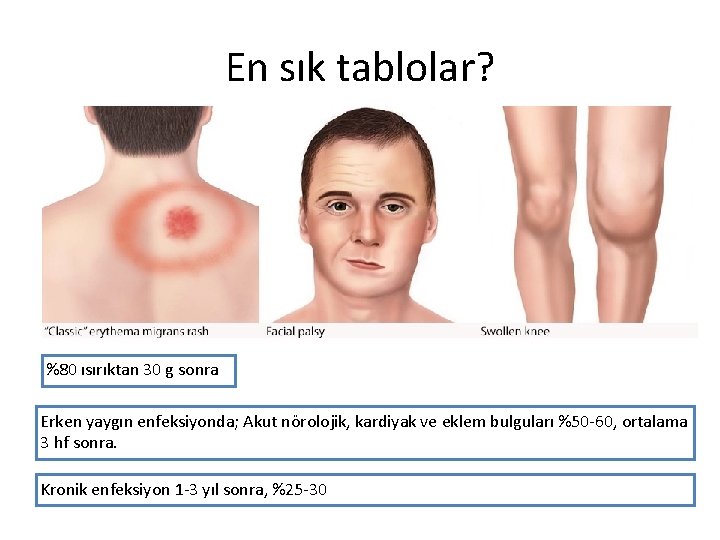 En sık tablolar? %80 ısırıktan 30 g sonra Erken yaygın enfeksiyonda; Akut nörolojik, kardiyak