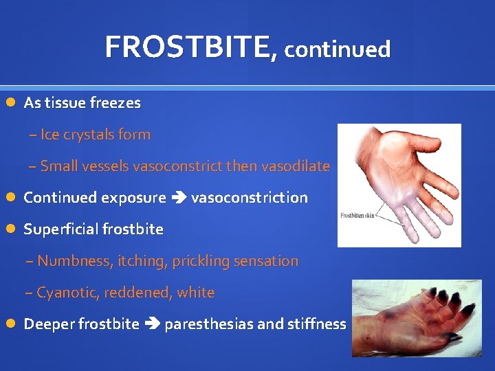 FROSTBITE, continued As tissue freezes − Ice crystals form − Small vessels vasoconstrict then