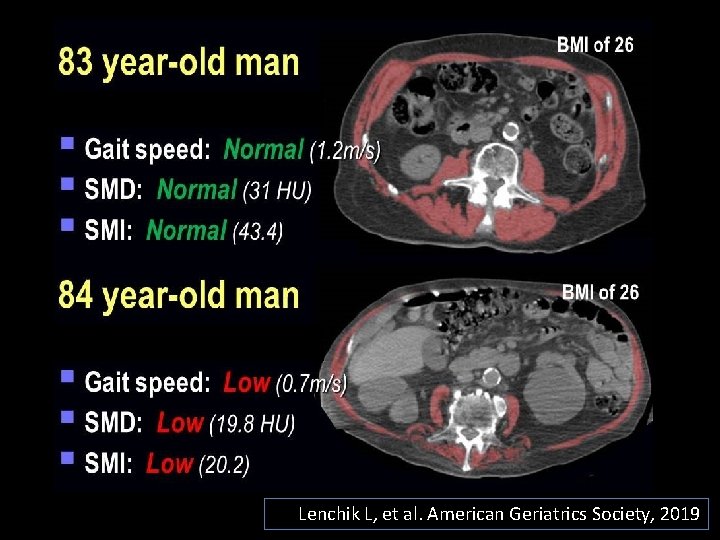 Lenchik L, et al. American Geriatrics Society, 2019 