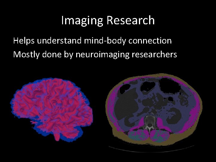 Imaging Research Helps understand mind-body connection Mostly done by neuroimaging researchers 