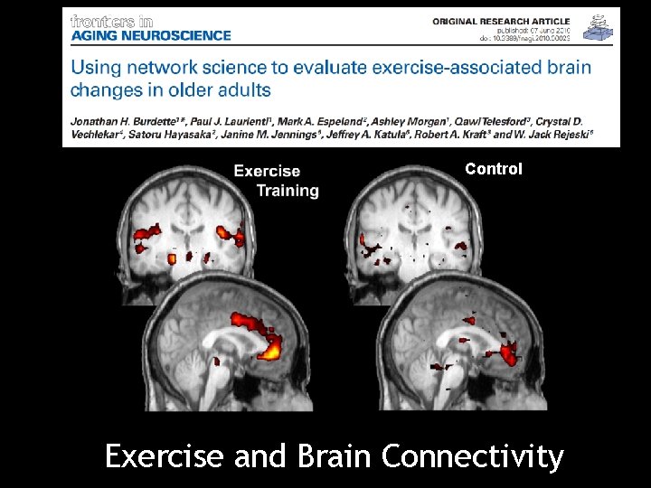 Control Exercise and Brain Connectivity 