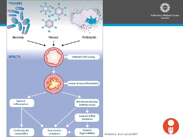 Wedzicha, et al. Lancet 2007 