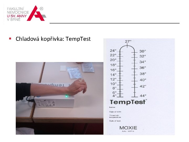  Chladová kopřivka: Temp. Test 