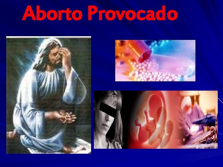 Aborto Provocado 