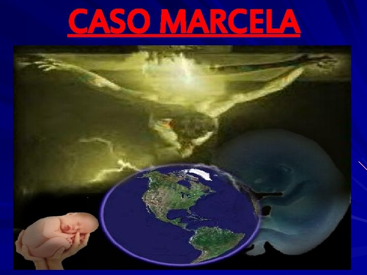 CASO MARCELA 