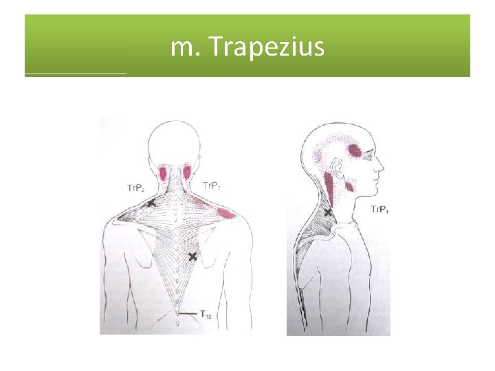 m. Trapezius 