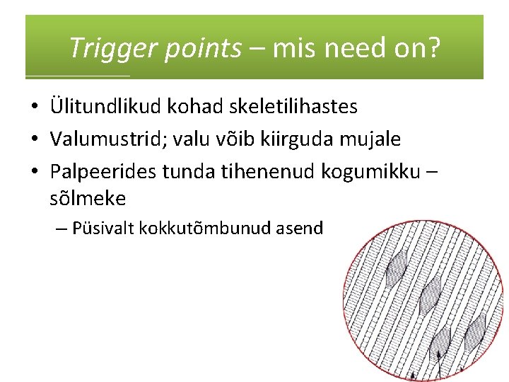 Trigger points – mis need on? • Ülitundlikud kohad skeletilihastes • Valumustrid; valu võib