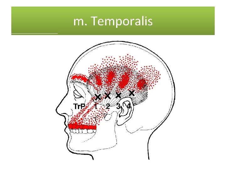 m. Temporalis 