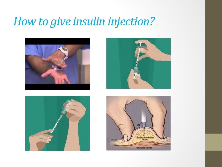 How to give insulin injection? 