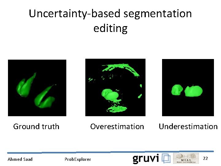 Uncertainty-based segmentation editing Ground truth Ahmed Saad Overestimation Prob. Explorer Underestimation 22 