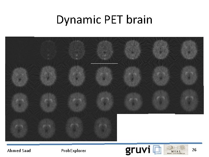 Dynamic PET brain Ahmed Saad Prob. Explorer 26 