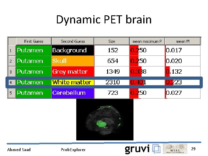 Dynamic PET brain Ahmed Saad Prob. Explorer 29 