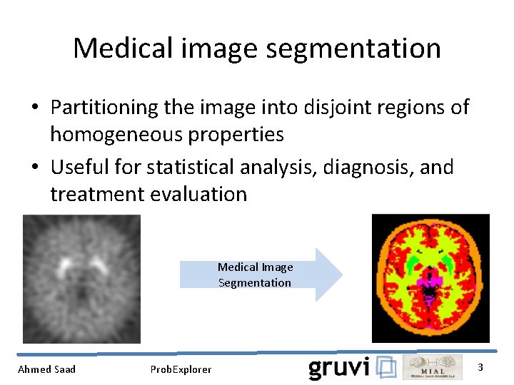 Medical image segmentation • Partitioning the image into disjoint regions of homogeneous properties •