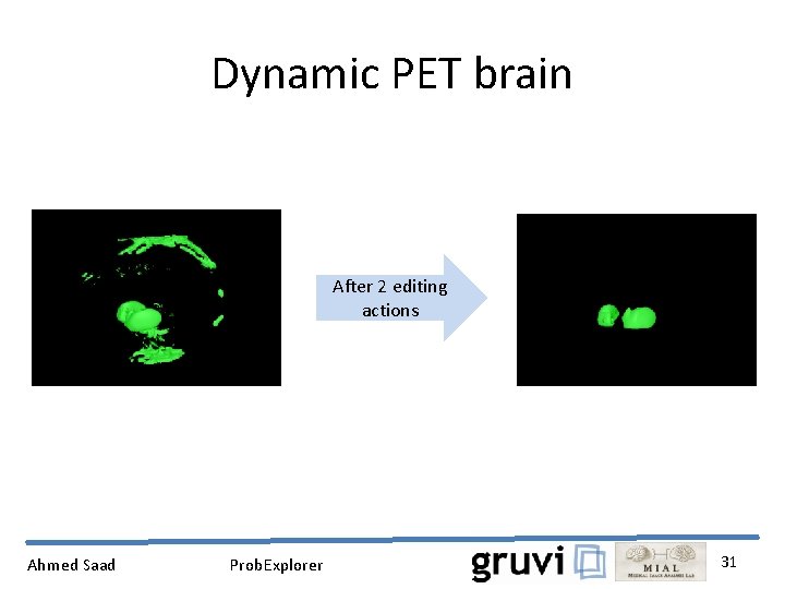 Dynamic PET brain After 2 editing actions Ahmed Saad Prob. Explorer 31 
