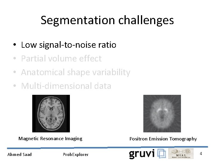 Segmentation challenges • • Low signal-to-noise ratio Partial volume effect Anatomical shape variability Multi-dimensional
