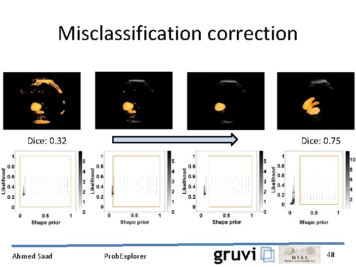 Misclassification correction Dice: 0. 32 Ahmed Saad Dice: 0. 75 Prob. Explorer 48 