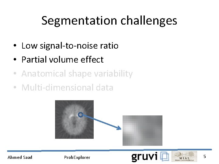 Segmentation challenges • • Low signal-to-noise ratio Partial volume effect Anatomical shape variability Multi-dimensional