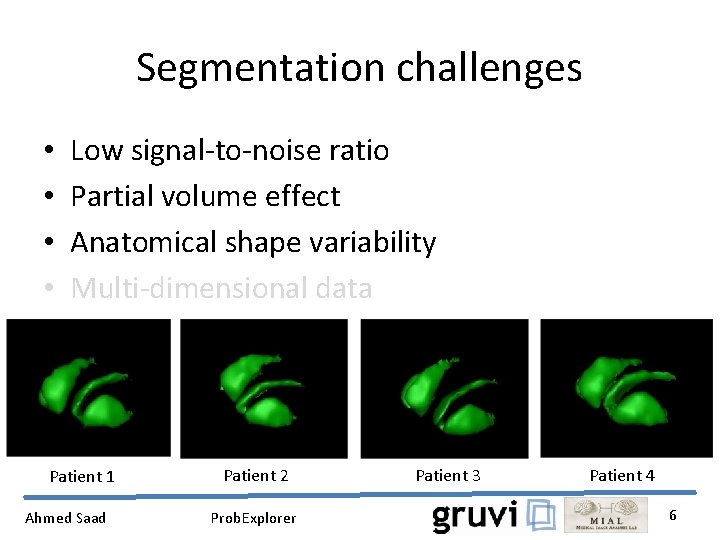 Segmentation challenges • • Low signal-to-noise ratio Partial volume effect Anatomical shape variability Multi-dimensional