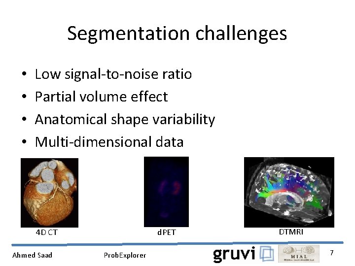 Segmentation challenges • • Low signal-to-noise ratio Partial volume effect Anatomical shape variability Multi-dimensional