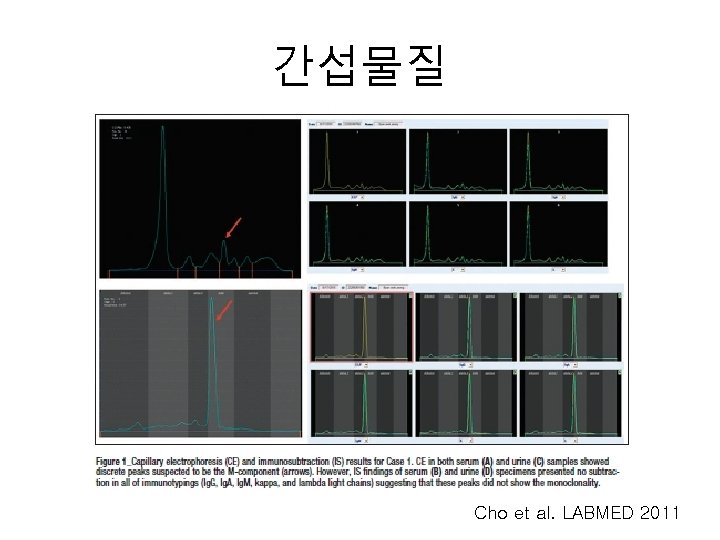 간섭물질 Cho et al. LABMED 2011 