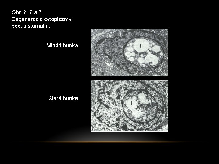 Obr. č. 6 a 7 Degenerácia cytoplazmy počas starnutia. Mladá bunka Stará bunka 