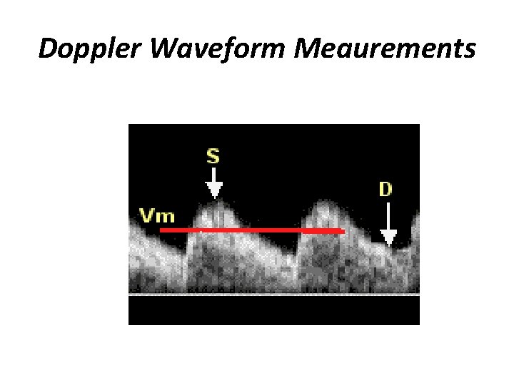 Doppler Waveform Meaurements 