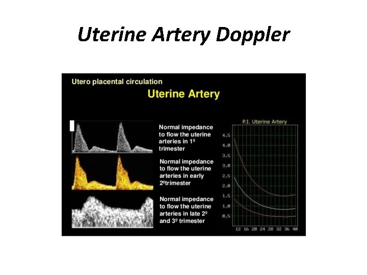 Uterine Artery Doppler 