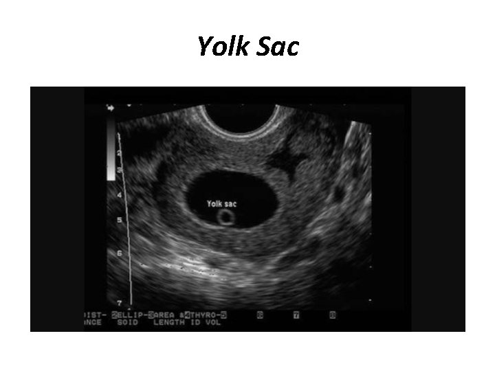 Yolk Sac 