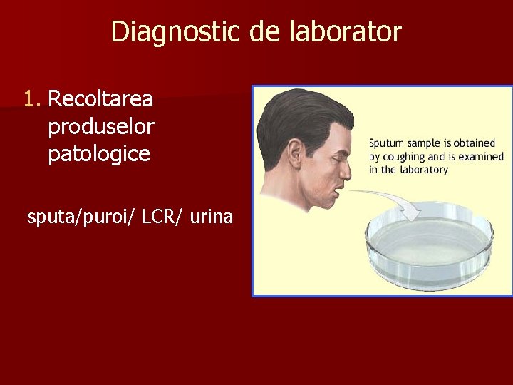 Diagnostic de laborator 1. Recoltarea produselor patologice sputa/puroi/ LCR/ urina 