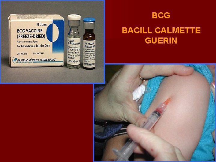 BCG BACILL CALMETTE GUERIN 