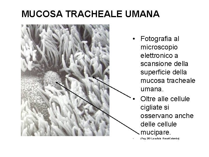 MUCOSA TRACHEALE UMANA • Fotografia al microscopio elettronico a scansione della superficie della mucosa