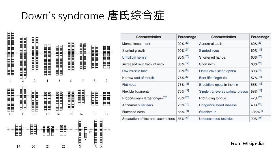Down’s syndrome 唐氏综合症 From Wikipedia 