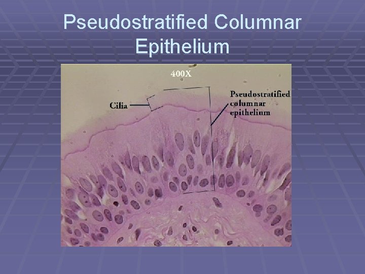 Pseudostratified Columnar Epithelium 