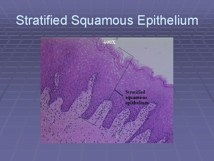 Stratified Squamous Epithelium 